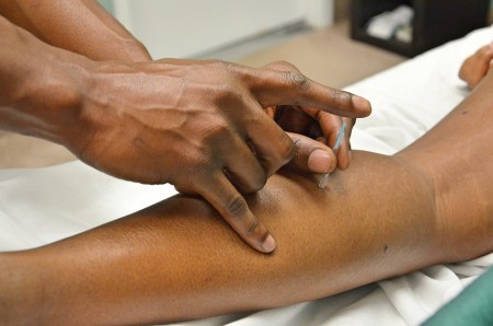 points acupuncture